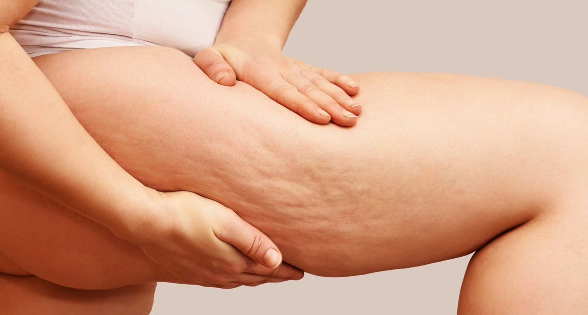 Combat Cellulite Naturally: Essential Oils & Wellness Tips for Smooth Skin