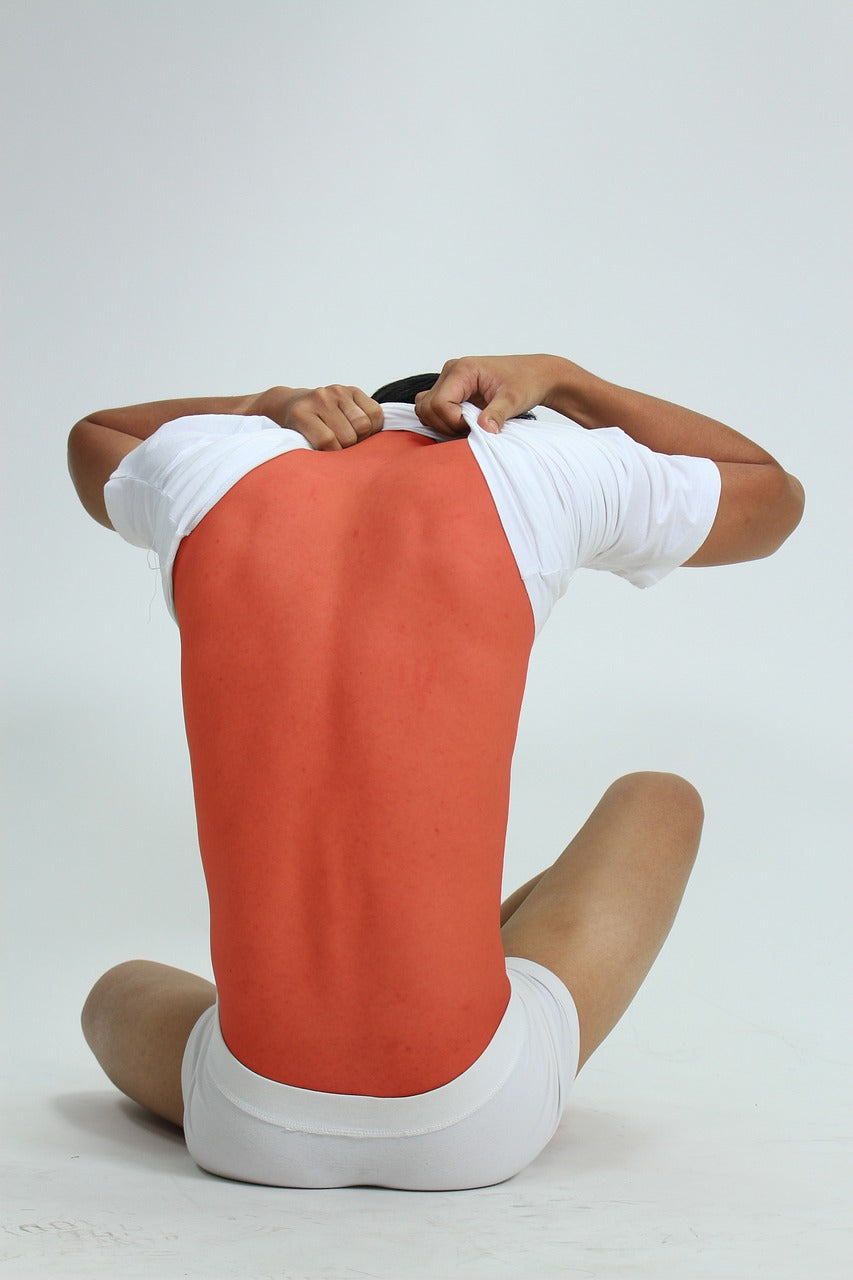 Natural Remedies for Burns and Sunburns: The Healing Power of Essential Oils