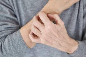 How To Relieve Itching Naturally With Essential Oils