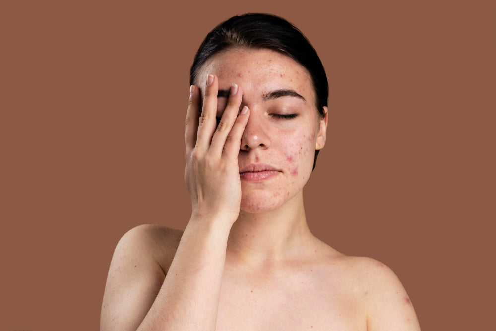 Natural Remedies for Scar Reduction: Harnessing the Power of Essential Oils